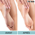 Load image into Gallery viewer, Lime À Pied Électrique Pour Nettoyage De La Peau Dure Et Morte De Talons Et Ongles À 2 Rouleau
