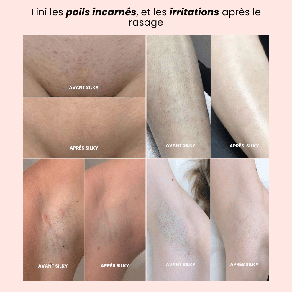 SILKY-Tondeuse Rasoir 2.0