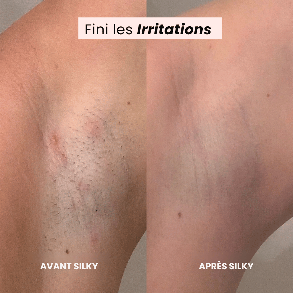 SILKY-Tondeuse Rasoir 2.0